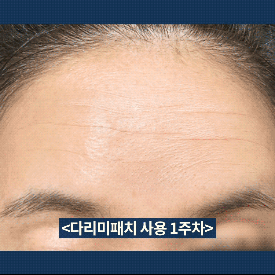 07_후킹.gif