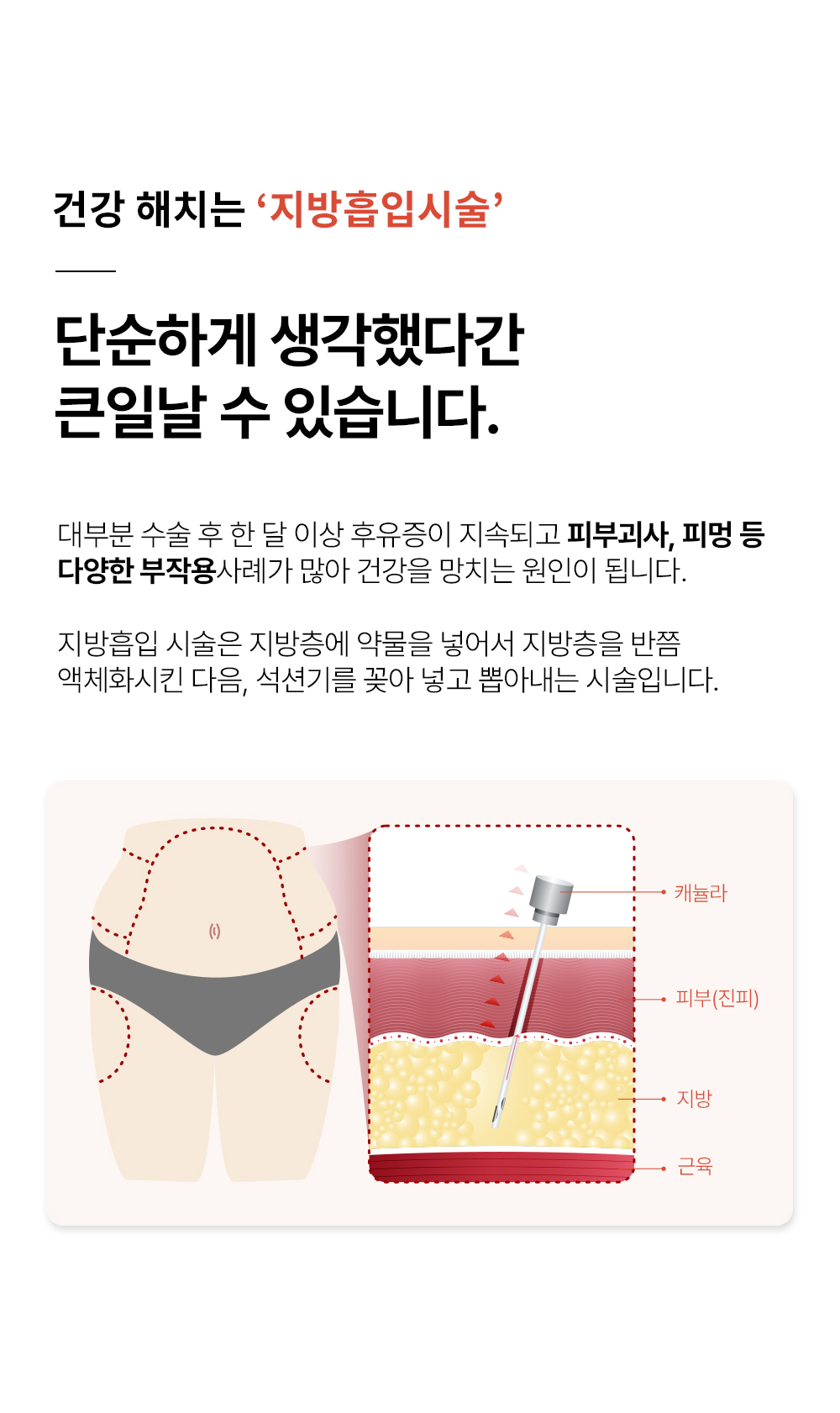 쿠도-쉐입-상세페이지_크림_13.jpg