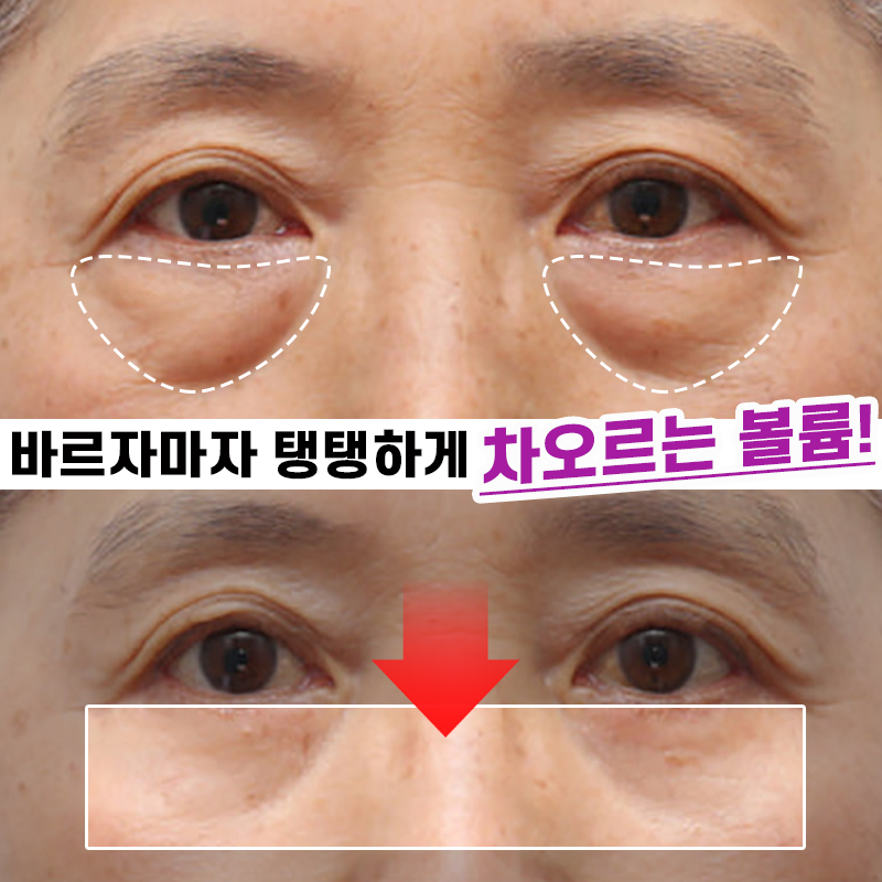 02.jpg
